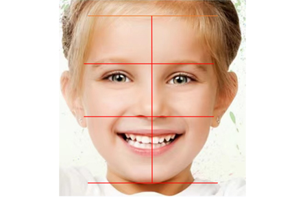 SDM Small Science | Influence of Orthodontics on Facial Shape of Teeth